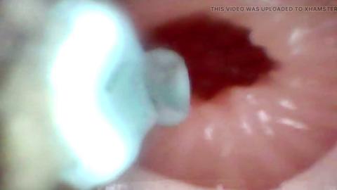Deep Dive: Lopuza93's Intimate Orals & Anal👌 Exploration with Endoscopic Thrill