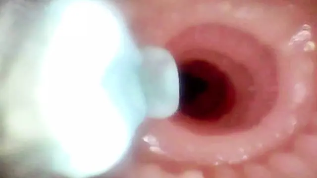 A close-up look at Lopuza93′s mouth and rectum with an endoscope lens 