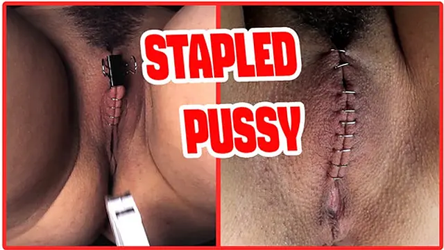 Sadistic doc tightens and seals his patient′s pussy✌