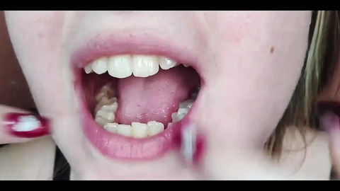 My Mouth, Teeth, Tongue and Throat up Close
